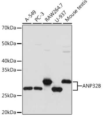 Western Blot: ANP32B Antibody (4A8E5) [NBP3-16199] - Western blot analysis of extracts of various cell lines, using ANP32B Rabbit mAb (NBP3-16199) at 1:1000 dilution. Secondary antibody: HRP Goat Anti-Rabbit IgG (H+L) at 1:10000 dilution. Lysates/proteins: 25ug per lane. Blocking buffer: 3% nonfat dry milk in TBST. Detection: ECL Basic Kit. Exposure time: 3s.