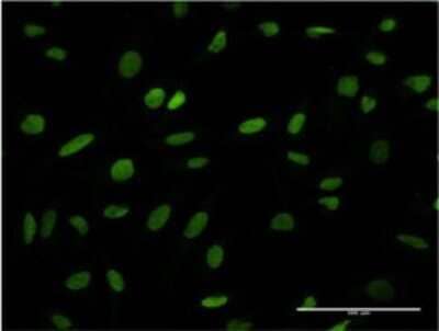 Immunocytochemistry/Immunofluorescence: ANP32B Antibody (8E10) [H00010541-M05] - Analysis of monoclonal antibody to ANP32B on HeLa cell. Antibody concentration 10 ug/ml