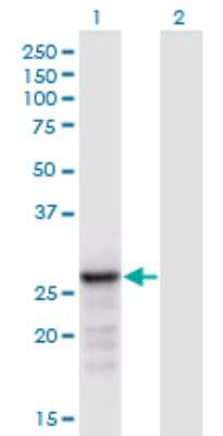 Western Blot: ANP32B Antibody (8E10) [H00010541-M05] - Analysis of ANP32B expression in transfected 293T cell line by ANP32B monoclonal antibody (M05), clone 8E10. Lane 1: ANP32B transfected lysate (Predicted MW: 28.8 KDa). Lane 2: Non-transfected lysate.