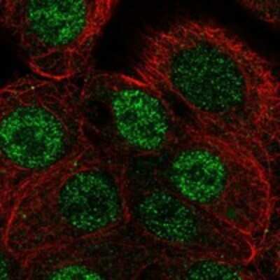 Immunocytochemistry/Immunofluorescence: ANP32B Antibody [NBP3-17193] - Staining of human cell line MCF7 shows localization to nucleoplasm.