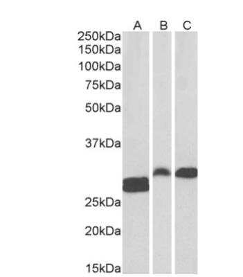 Western Blot: ANP32B Antibody [NB100-1199] - 0.1 ug/ml) staining of Human Tonsil (A) and Rat (B) and Pig (C) Spleen lysate (35 ug protein in RIPA buffer). Primary incubation was 1 hour. Detected by chemiluminescence.