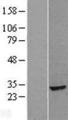 Western Blot: ANP32B Overexpression Lysate (Adult Normal) [NBL1-07551] Left-Empty vector transfected control cell lysate (HEK293 cell lysate); Right -Over-expression Lysate for ANP32B.