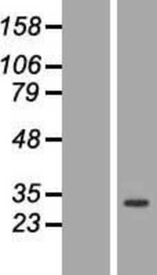 Western Blot: ANP32C Overexpression Lysate (Adult Normal) [NBP2-07449] Left-Empty vector transfected control cell lysate (HEK293 cell lysate); Right -Over-expression Lysate for ANP32C.