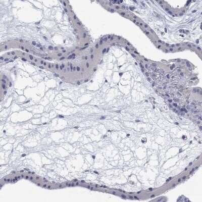 Immunohistochemistry-Paraffin ANUBL1 Antibody - BSA Free