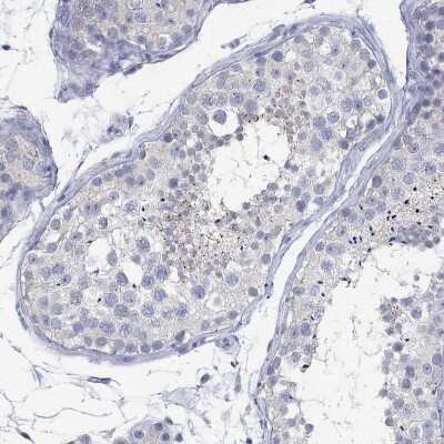 Immunohistochemistry-Paraffin ANUBL1 Antibody - BSA Free