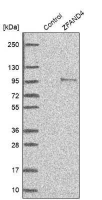 Western Blot: ANUBL1 Antibody [NBP1-81916] - Analysis in control (vector only transfected HEK293T lysate) and ZFAND4 over-expression lysate (Co-expressed with a C-terminal myc-DDK tag (3.1 kDa) in mammalian HEK293T cells).