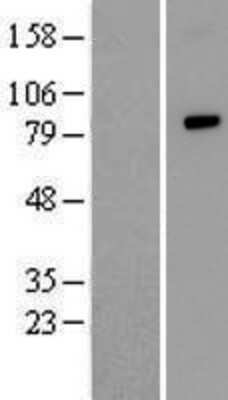 Western Blot ANUBL1 Overexpression Lysate