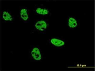 Immunocytochemistry/Immunofluorescence: AP-2 beta/TFAP2B Antibody (2F6) [H00007021-M02] - Analysis of monoclonal antibody to TFAP2B on HeLa cell . Antibody concentration 10 ug/ml.