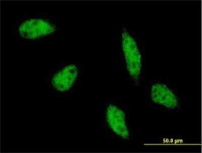 Immunocytochemistry/Immunofluorescence: AP-2 beta/TFAP2B Antibody (3G5-1D11) [H00007021-M01] - Analysis of monoclonal antibody to TFAP2B on HeLa cell . Antibody concentration 10 ug/ml.