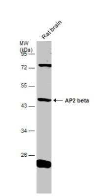 Western Blot: AP-2 beta/TFAP2B Antibody [NBP2-20606] - Rat tissue extract (50 ug) was separated by 10% SDS-PAGE, and the membrane was blotted with AP2 beta antibody diluted at 1:500.