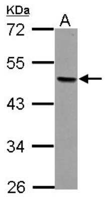 Western Blot: AP-2 beta/TFAP2B Antibody [NBP2-20606] -  Sample (30 ug of whole cell lysate) A: MCF-7 10% SDS PAGE gel, diluted at 1:1000.