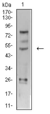 Western Blot: AP-2 gamma Antibody (3A11A5) [NBP2-61859] - Analysis using TFAP2C mouse mAb against SK-Br-3 (1) cell lysate.