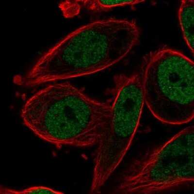 Immunocytochemistry/Immunofluorescence: AP-2 gamma Antibody [NBP2-49170] - Immunofluorescent staining of human cell line PC-3 shows localization to nucleoplasm.