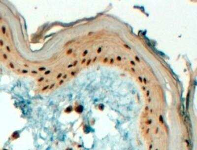 Immunohistochemistry-Paraffin: AP-2 gamma Antibody [NB100-1516] -  (4ug/ml) Staining of Human Skin. Steamed antigen retrieval with Tris/EDTA buffer pH 9, HRP-staining.