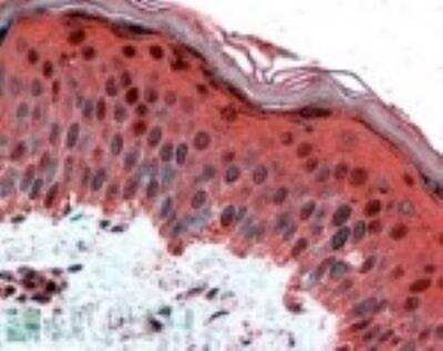 Immunohistochemistry-Paraffin: AP-2 gamma Antibody [NB100-1516] - Staining of AP-2 gamma in paraffin embedded Human Skin using NB100-1516 at 2.5ug/ml. Steamed antigen retrieval with citrate buffer pH 6, AP-staining.