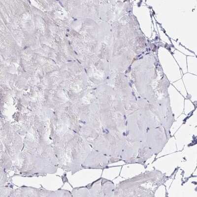 Immunohistochemistry-Paraffin: AP-2 gamma Antibody [NBP2-49170] - Staining of human skeletal muscle shows low expression as expected.