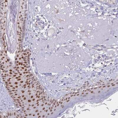 Immunohistochemistry-Paraffin: AP-2 gamma Antibody [NBP2-49170] - Staining of human skin shows high expression.