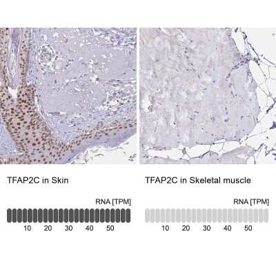 Immunohistochemistry-Paraffin AP-2 gamma Antibody