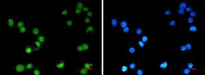 Immunocytochemistry/Immunofluorescence: AP-2 gamma Antibody (S03-8I2) [NBP3-14996] - Immunofluorescence of AP-2 gamma (green) in MCF-7 using TFAP2C/AP-2 gamma antibody at dilution 1/20, and DAPI (blue)