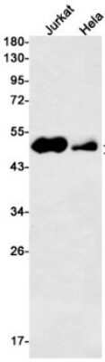 Western Blot: AP-2 gamma Antibody (S03-8I2) [NBP3-14996] - Western blot detection of AP-2 gamma in Jurkat, Hela cell lysates using TFAP2C/AP-2 gamma Rabbit mAb (1:500 diluted). Predicted band size: 49kDa. Observed band size: 49kDa.