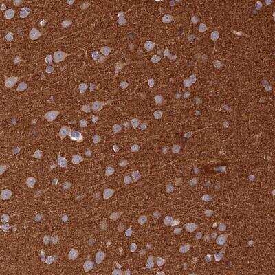 Immunohistochemistry: AP180 Antibody [NBP1-90146] - Staining of human cerebral cortex shows weak cytoplasmic positivity in neuronal cells and strong staining in neuropil.