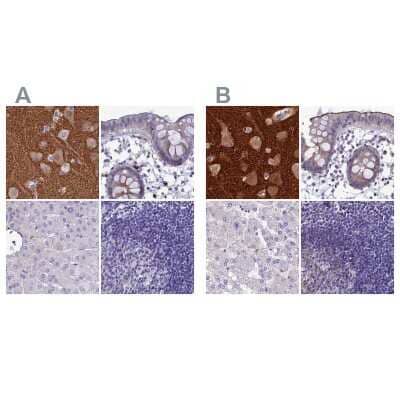 <b>Independent Antibodies Validation. </b>Immunohistochemistry-Paraffin: AP180 Antibody [NBP1-90146] - Staining of human cerebral cortex, colon, liver and lymph node using Anti-SNAP91 antibody NBP1-90146 (A) shows similar protein distribution across tissues to independent antibody NBP1-90147 (B).