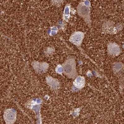 Immunohistochemistry-Paraffin: AP180 Antibody [NBP1-90146] - Staining of human cerebral cortex.