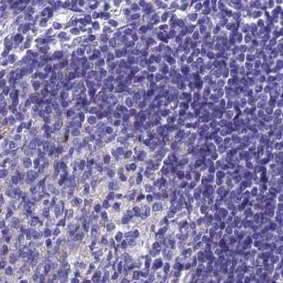 Immunohistochemistry-Paraffin: AP180 Antibody [NBP1-90146] - Staining of human lymph node.