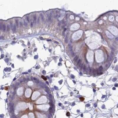 Immunohistochemistry-Paraffin AP180 Antibody