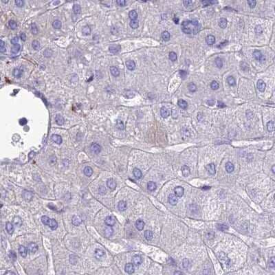 Immunohistochemistry-Paraffin: AP180 Antibody [NBP1-90146] - Staining of human liver.