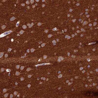 Immunohistochemistry-Paraffin: AP180 Antibody [NBP1-90147] - Staining of human cerebral cortex shows moderate cytoplasmic positivity neuronal cells and strong staining in neuropil.