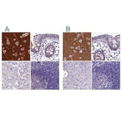 <b>Independent Antibodies Validation. </b>Immunohistochemistry-Paraffin: AP180 Antibody [NBP1-90147] - Staining of human cerebral cortex, colon, liver and lymph node using Anti-SNAP91 antibody NBP1-90147 (A) shows similar protein distribution across tissues to independent antibody NBP1-90146 (B).