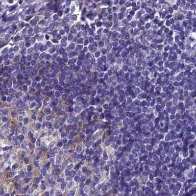 Immunohistochemistry-Paraffin: AP180 Antibody [NBP1-90147] - Staining of human lymph node.