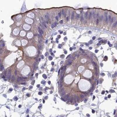 Immunohistochemistry-Paraffin: AP180 Antibody [NBP1-90147] - Staining of human colon.