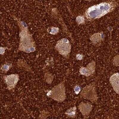 Immunohistochemistry-Paraffin AP180 Antibody