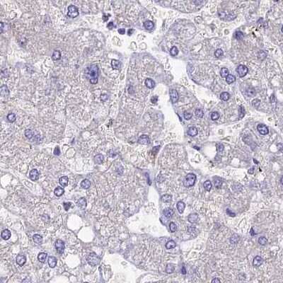 Immunohistochemistry-Paraffin: AP180 Antibody [NBP1-90147] - Staining of human liver.