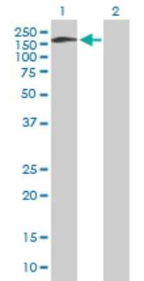 Western Blot: AP180 Antibody [H00009892-B01P] - Analysis of SNAP91 expression in transfected 293T cell line by SNAP91 polyclonal antibody.  Lane 1: SNAP91 transfected lysate(99.77 KDa). Lane 2: Non-transfected lysate.