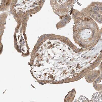 Immunohistochemistry-Paraffin AP1AR Antibody