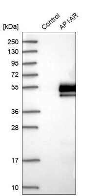 Western Blot AP1AR Antibody