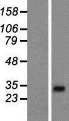 Western Blot AP1AR Overexpression Lysate