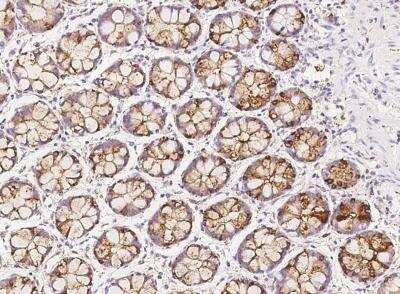 Immunohistochemistry-Paraffin: AP1G2 Antibody [NBP3-05786] - Staining of human AP1G2 in human rectum with rabbit polyclonal antibody at 1:500 dilution.