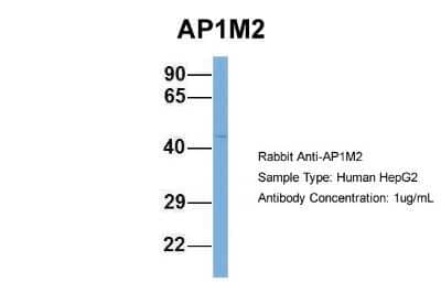 Western Blot AP1M2 Antibody