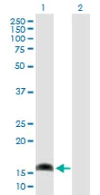 Western Blot: AP1S1 Antibody [H00001174-B02P] - Analysis of AP1S1 expression in transfected 293T cell line by AP1S1 polyclonal antibody.  Lane 1: AP1S1 transfected lysate(18.70 KDa). Lane 2: Non-transfected lysate.