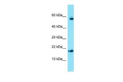 Western Blot AP1S1 Antibody