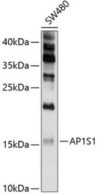 Western Blot: AP1S1 Antibody [NBP2-92032] - Analysis of extracts of SW480 cells, using AP1S1 .Exposure time: 30s.