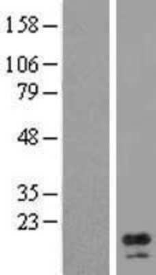 Western Blot AP1S1 Overexpression Lysate