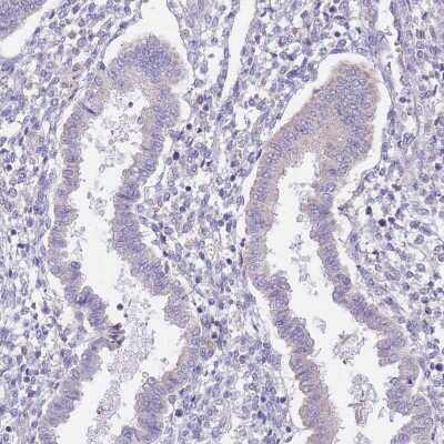 Immunohistochemistry-Paraffin AP1S2 Antibody