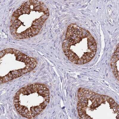 Immunohistochemistry-Paraffin AP1S2 Antibody