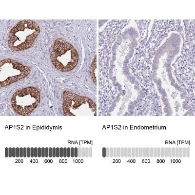 Immunohistochemistry-Paraffin AP1S2 Antibody