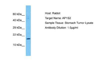 Western Blot: AP1S2 Antibody [NBP2-87010] - Host: Rabbit. Target Name: AP1S2. Sample Type: Stomach Tumor lysates. Antibody Dilution: 1.0ug/ml